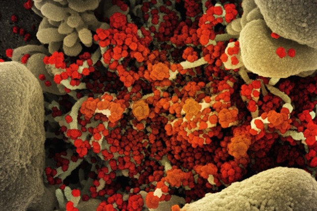 Microbiote intestinal : pourquoi il influence votre énergie